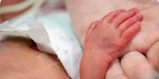 Singleton Neonatal<br/>Intensive Care Unit (NICU)